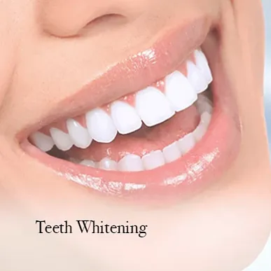 Teeth Whitening